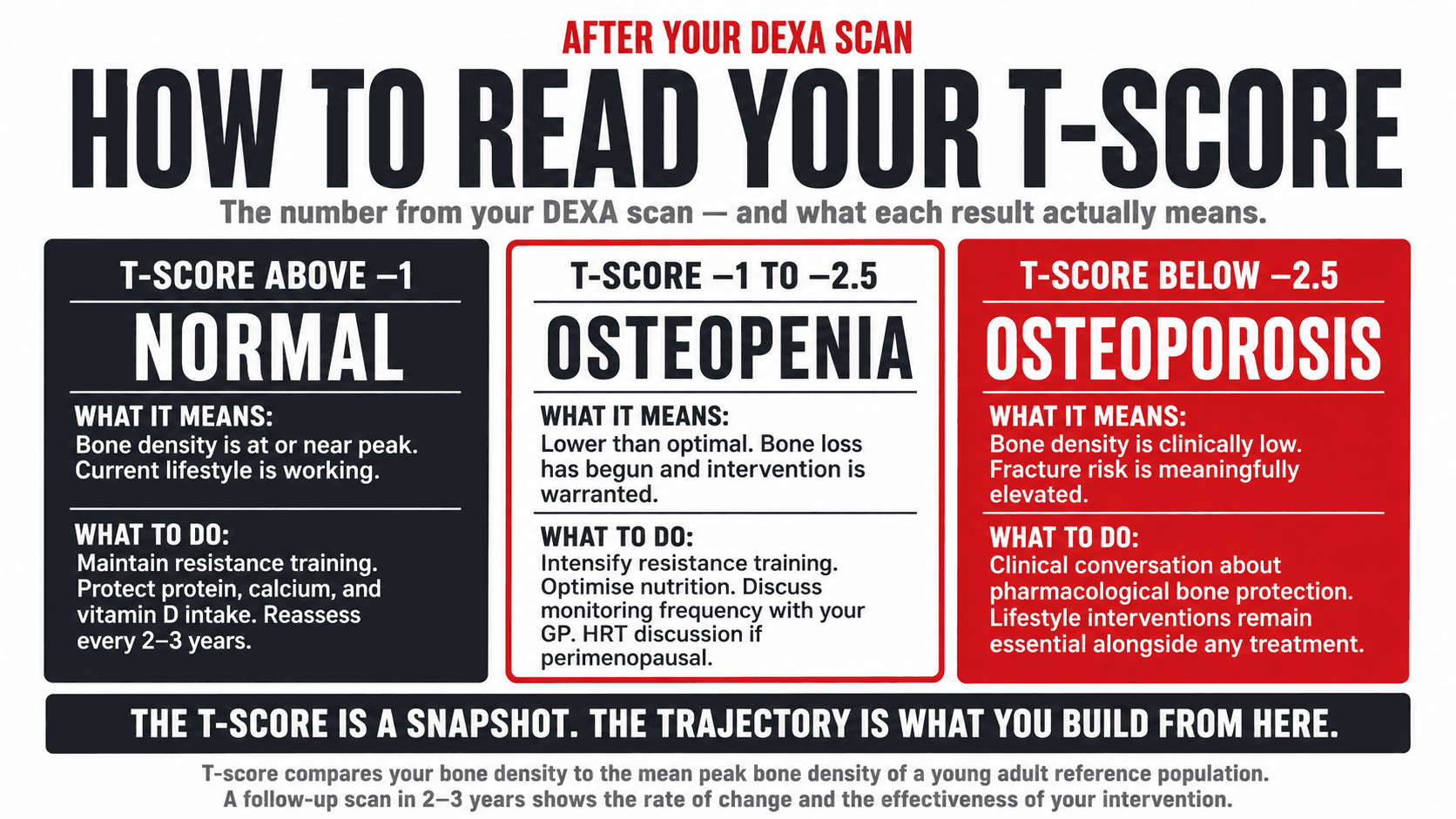Infographic titled 'How to Read Your T-Score' presented as a three-zone visualisation showing the clinical interpretation of DEXA scan results: T-score above minus one classified as normal bone density, between minus one and minus two point five classified as osteopenia warranting lifestyle intervention, and below minus two point five classified as osteoporosis warranting clinical bone protection alongside lifestyle measures