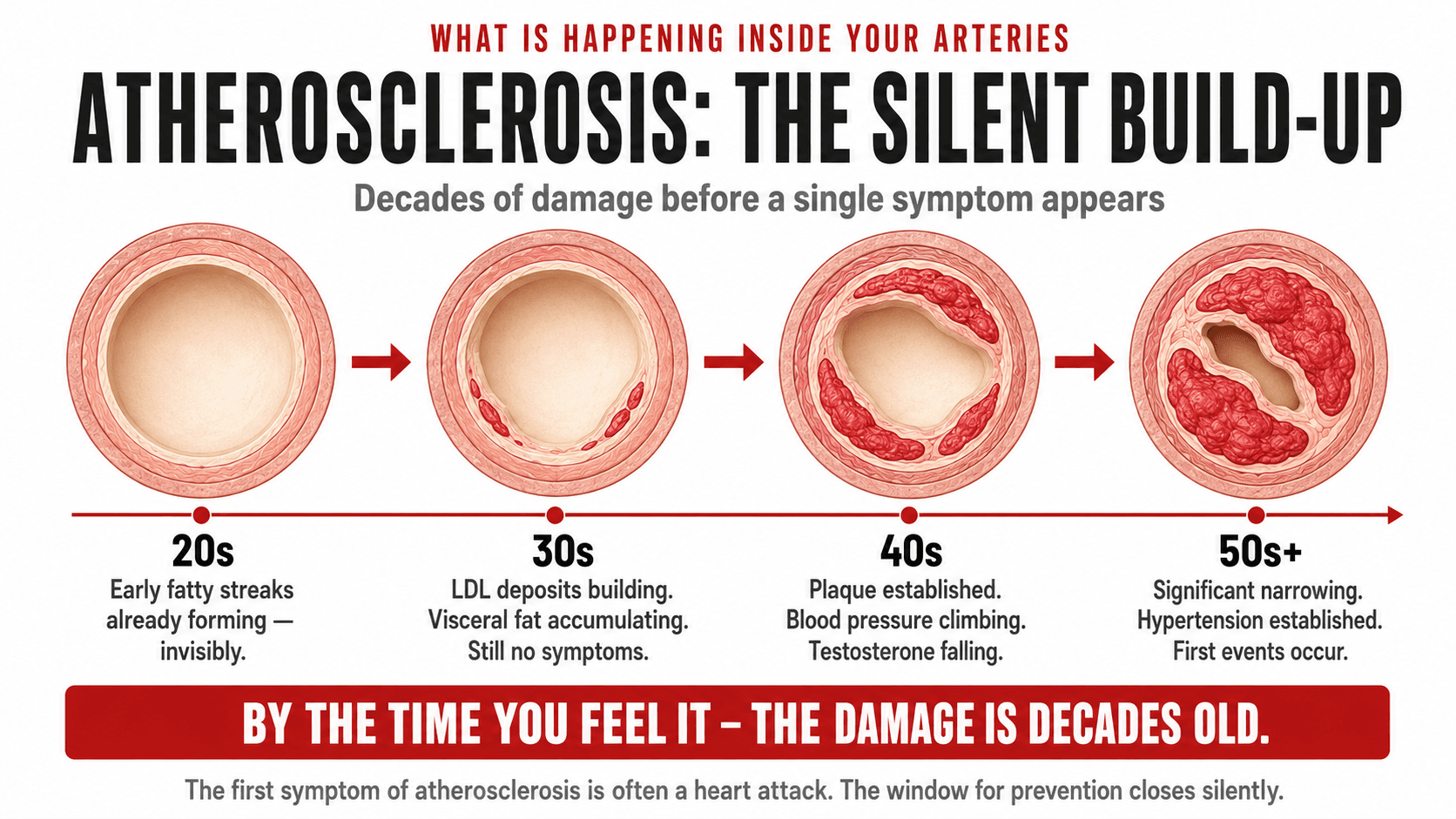 Infographic titled 'What Is Happening Inside Your Arteries — Atherosclerosis: The Silent Build-Up — decades of damage before a single symptom appears' showing a four-stage medical-style cross-section of an artery: 20s (early fatty streaks already forming — invisibly), 30s (LDL deposits building, visceral fat accumulating, still no symptoms), 40s (plaque established, blood pressure climbs, testosterone falling), 50s+ (significant narrowing, hypertension established, first cardiac events occur), closing 'By the time you feel it — the damage is decades old. The first symptom of atherosclerosis is often a heart attack. The window for prevention closes silently.'