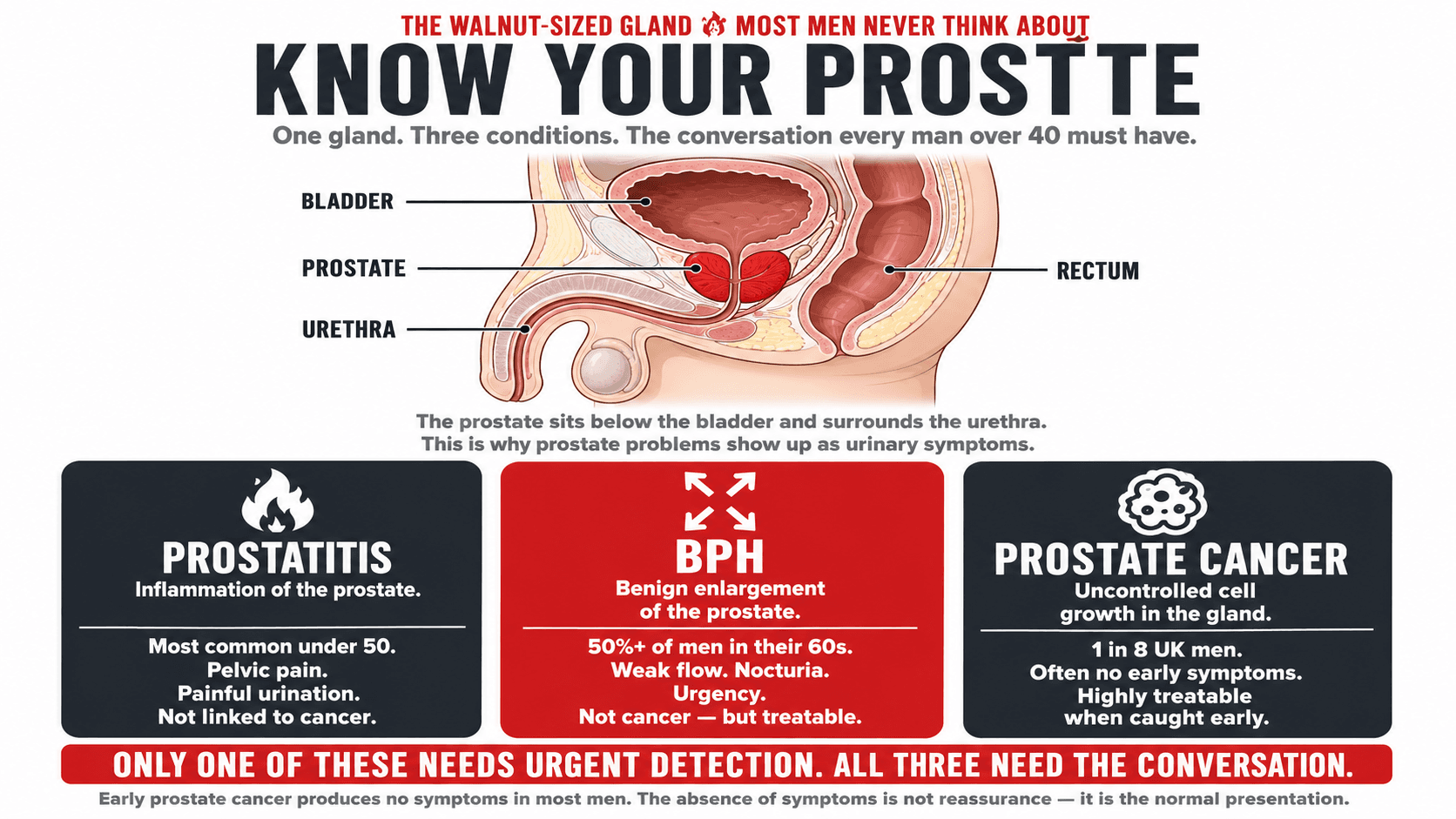 Infographic titled 'The Walnut-Sized Gland Most Men Never Think About — Know Your Prostate — one gland. Three conditions. The conversation every man over 40 must have.' showing a labelled anatomical cross-section of the prostate sitting below the bladder, in front of the rectum and surrounding the urethra, alongside three side-by-side condition panels: Prostatitis (inflammation of the prostate — most common under 50, pelvic pain, painful urination, not linked to cancer), BPH (benign enlargement of the prostate — 50%+ of men in their 60s, weak flow, nocturia, urgency, not cancer but related hormonally), and Prostate Cancer (uncontrolled cell growth in the gland — 1 in 8 UK men, often no early symptoms, highly treatable when caught early), closing 'Only one of these needs urgent detection. All three need the conversation. Early prostate cancer produces no symptoms in most men. The absence of symptoms is not reassurance — it is the normal presentation.'