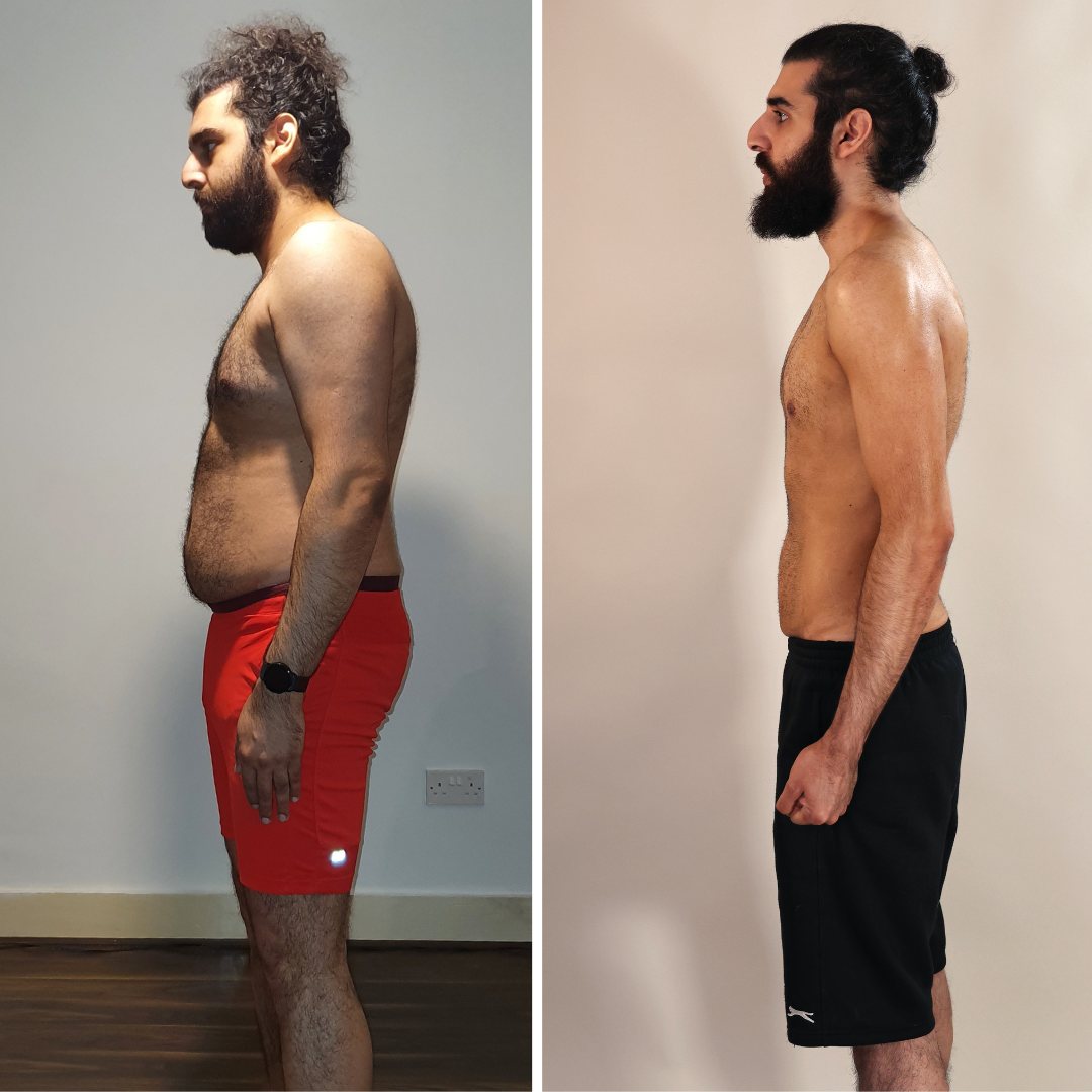Gurvir, side profile before and after