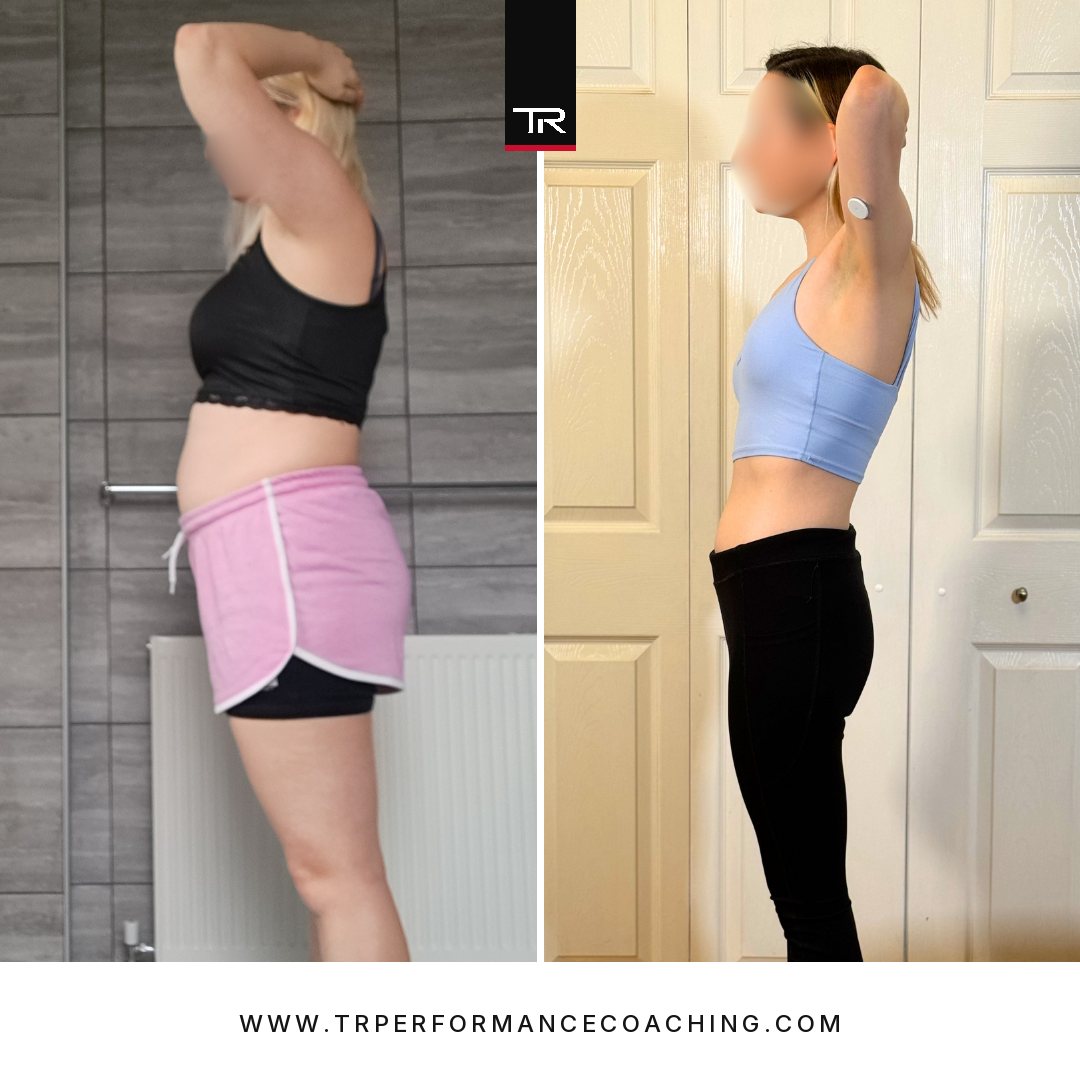 Hannah’s side profile before and after, showing a significant reduction around her waist and stomach